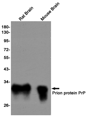 IHC - Prion Protein Rabbit mAb AP75949